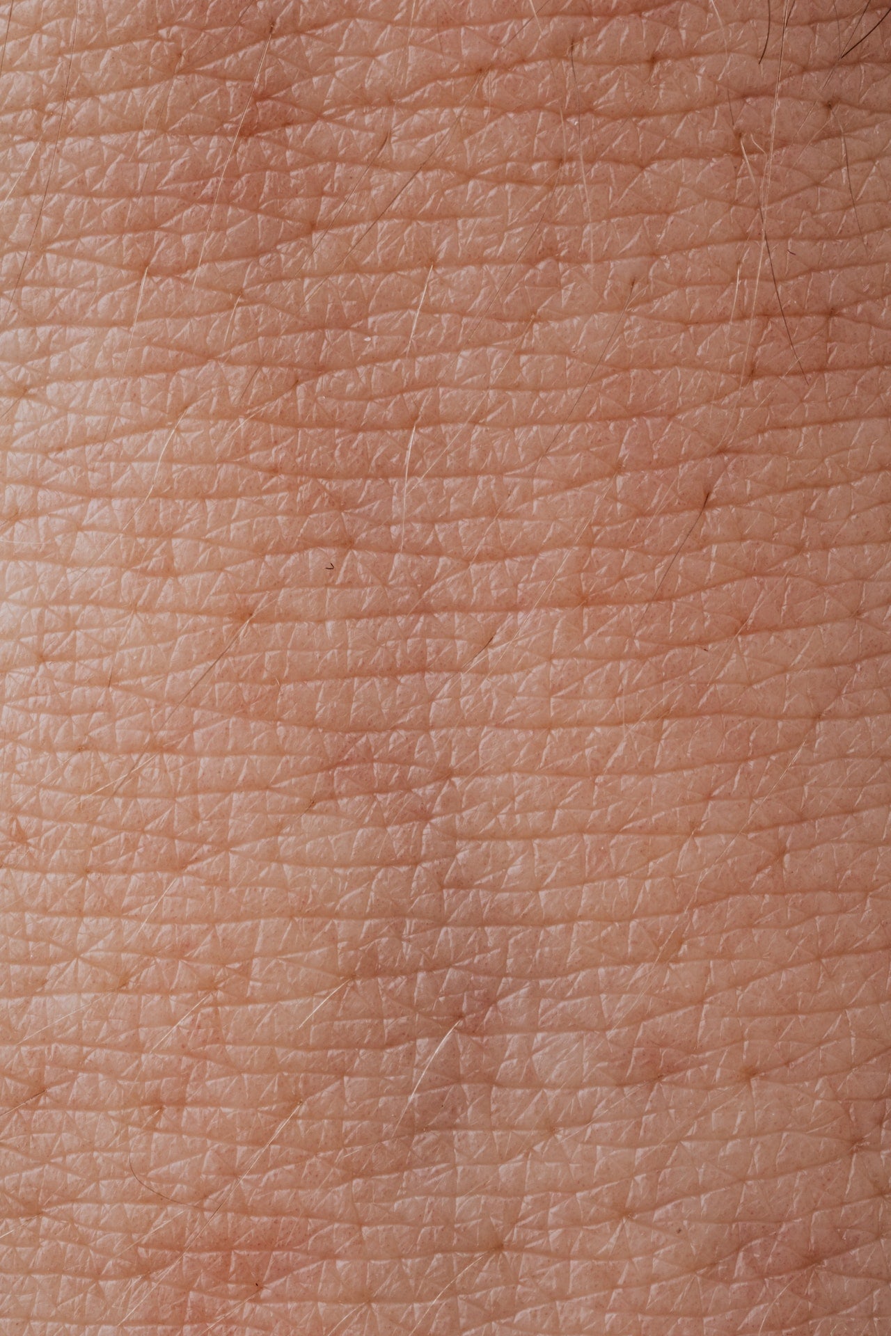 tipos de manchas na pele